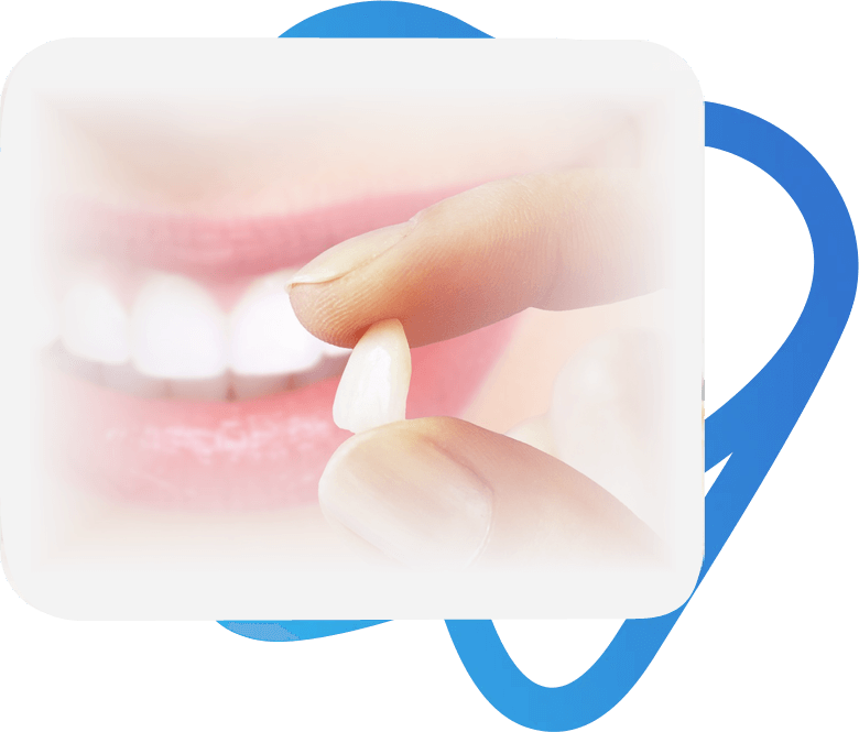 Lentes de Contato + Facetas – dentista em sapopemba (1)